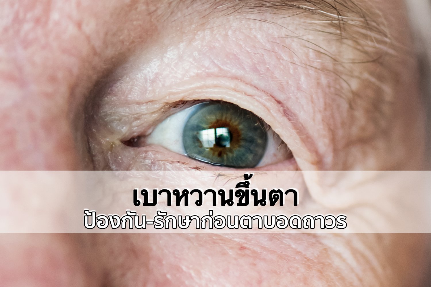 เบาหวานขึ้นตา อันตรายมากแค่ไหน วิธีการรักษาป้องกัน